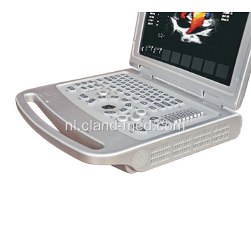 Hoge kwaliteit Laptop 4d draagbare kleuren Doppler echografie machine